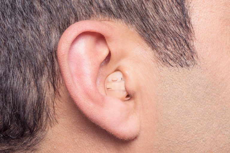 Nahaufnahme eines Im-Ohr-Hörsystems (IdO) zur Veranschaulichung der diskreten Platzierung direkt in der Ohrmuschel.